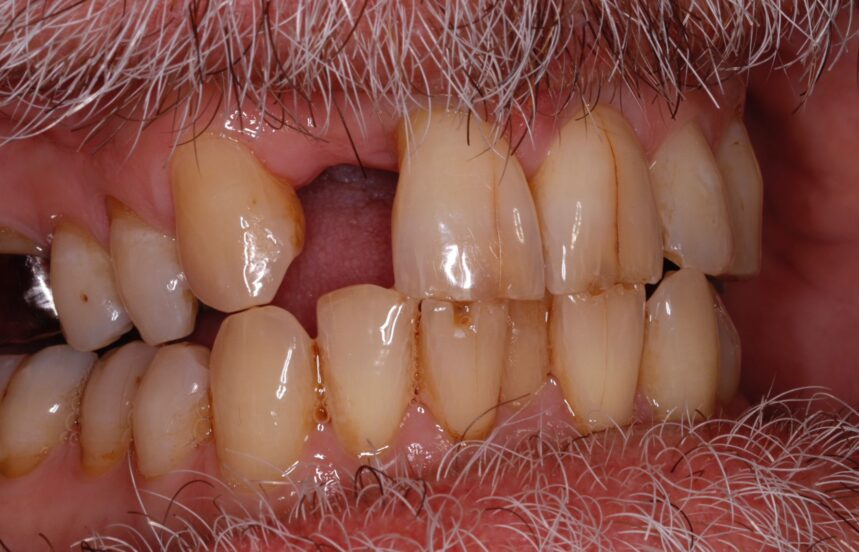 Before - Brigstock Dental