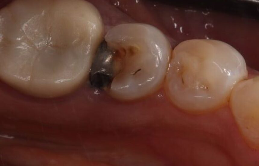 Before - Brigstock Dental