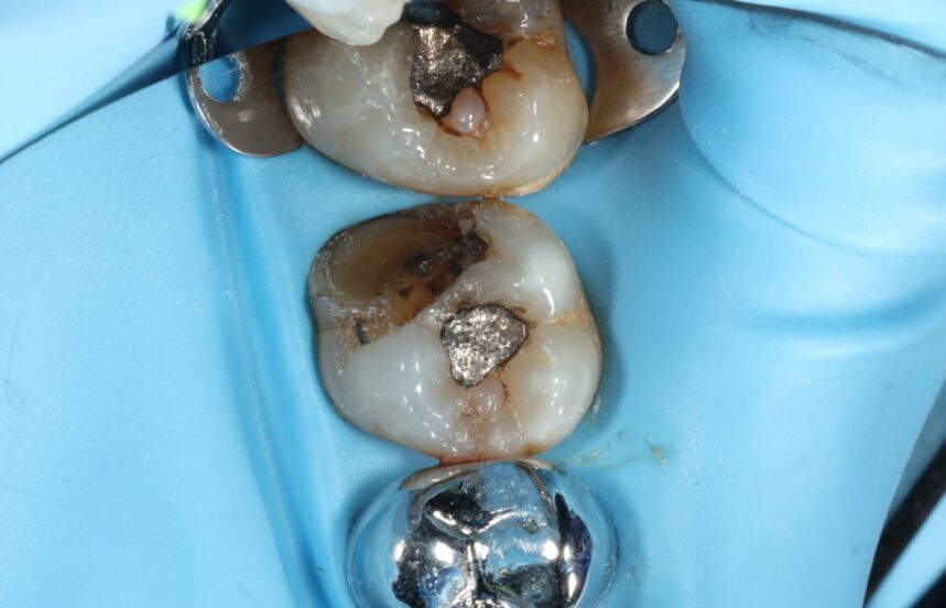 Before - Brigstock Dental