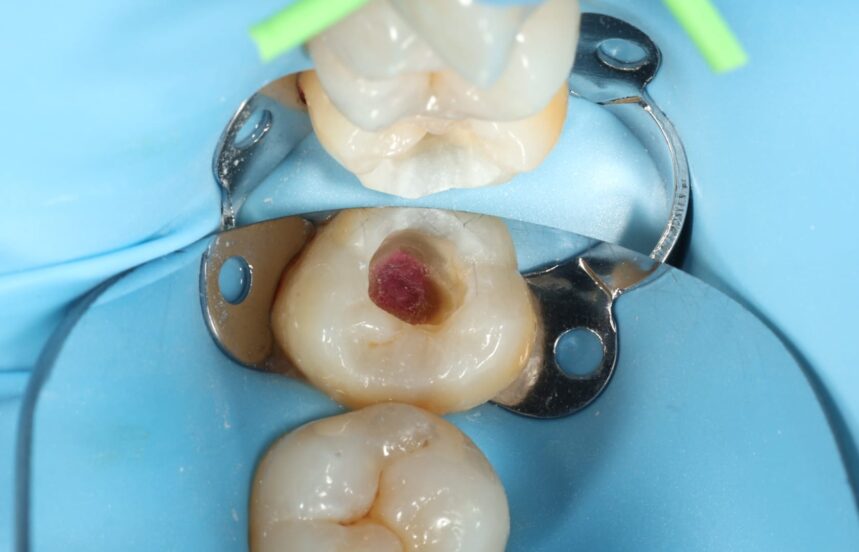 Before - Brigstock Dental